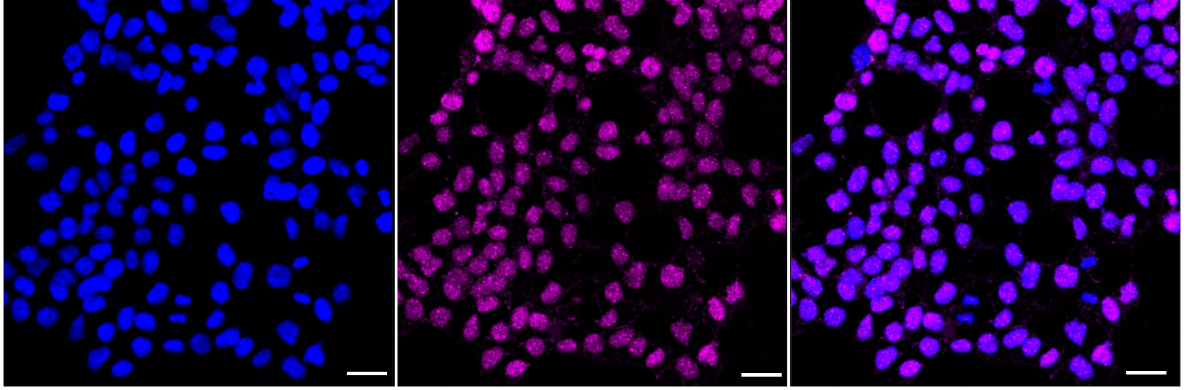 Islet-1 Antibody (23GB6115)