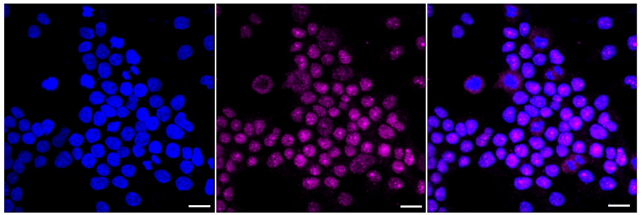 HMBS Antibody (23GB6130)