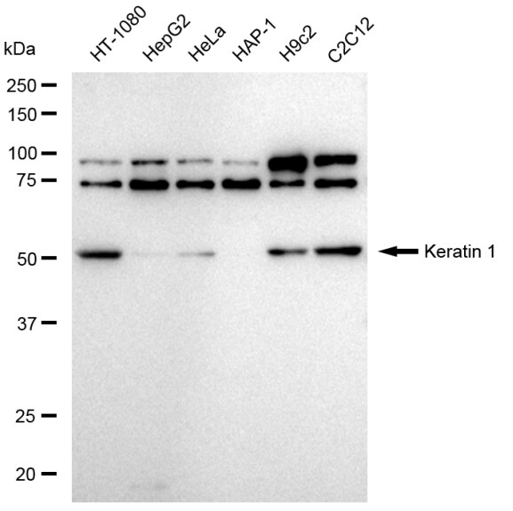 Cytokeratin 1 Antibody (23GB6135)