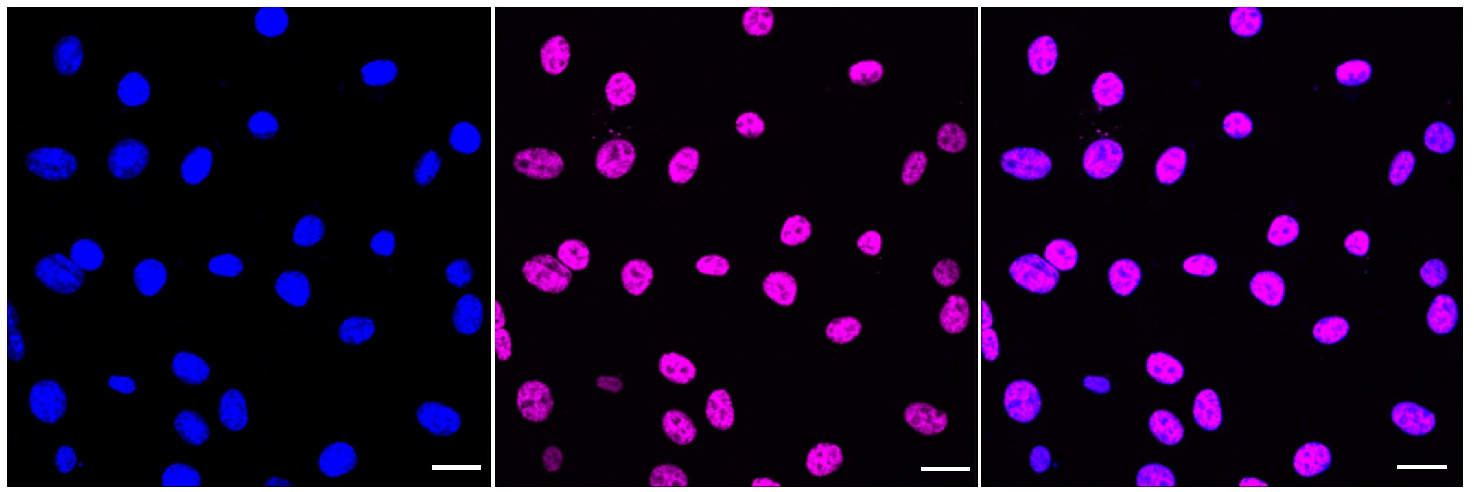 Histone H2B type 1B [ac Lys20] Antibody (23GB6140)