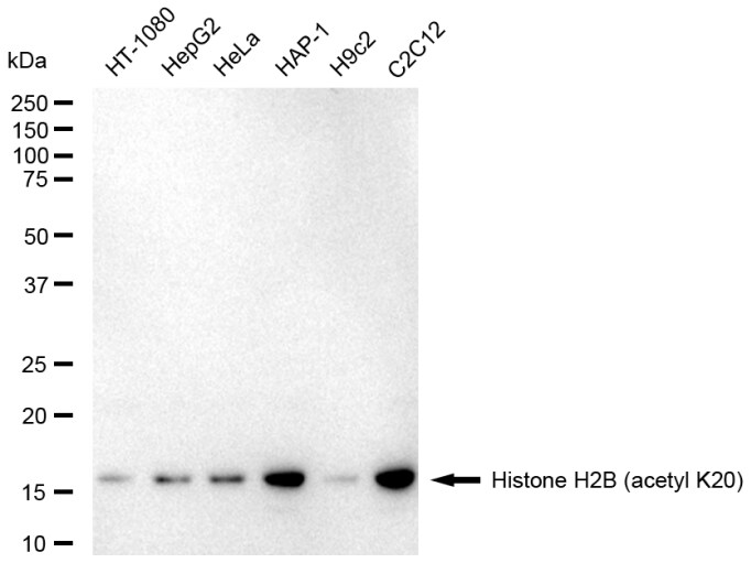 Histone H2B type 1B [ac Lys20] Antibody (23GB6140)