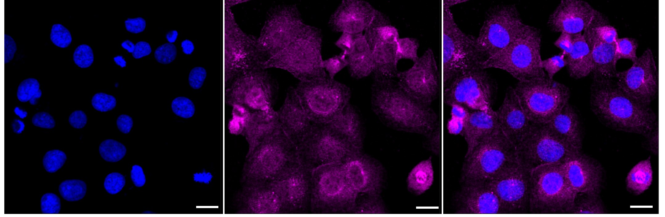 IRS1 Antibody (23GB6155)