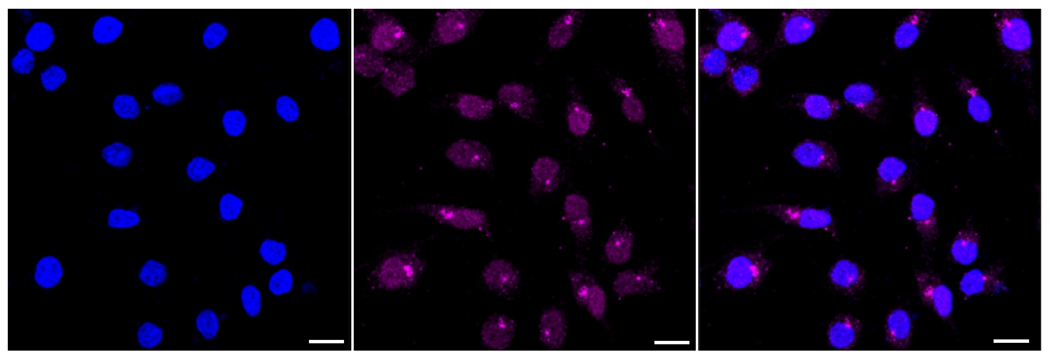 Histone Deacetylase 8/HDAC8 Antibody (23GB6180)