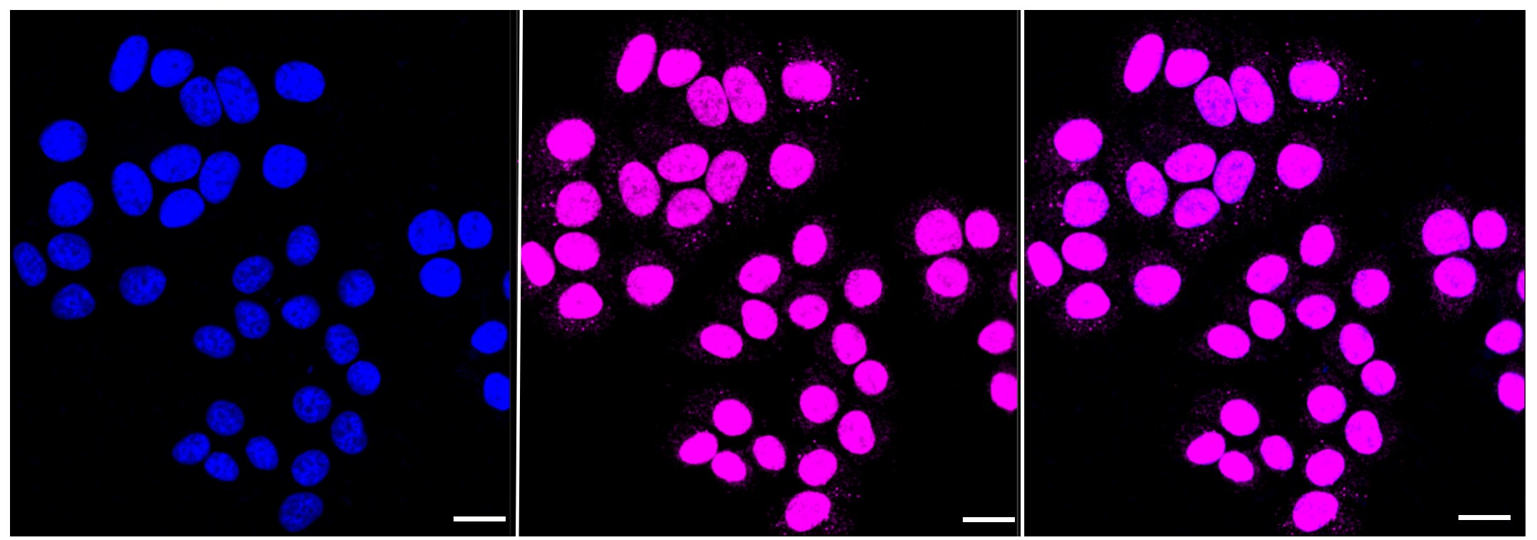 Histone Deacetylase 8/HDAC8 Antibody (23GB6185)