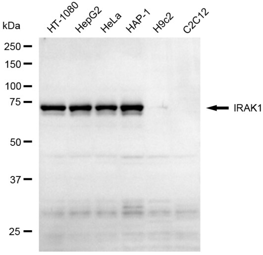 IRAK1 Antibody (23GB6250)