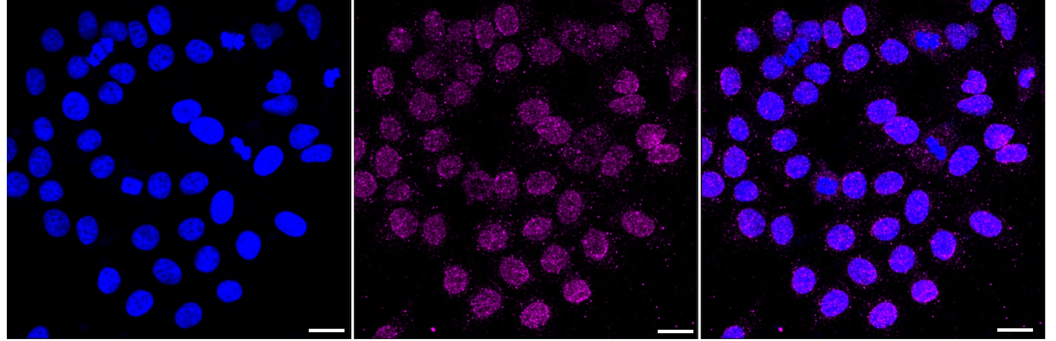 Histone H2B type 2E [Crotonyl Lys12] Antibody (23GB6335)