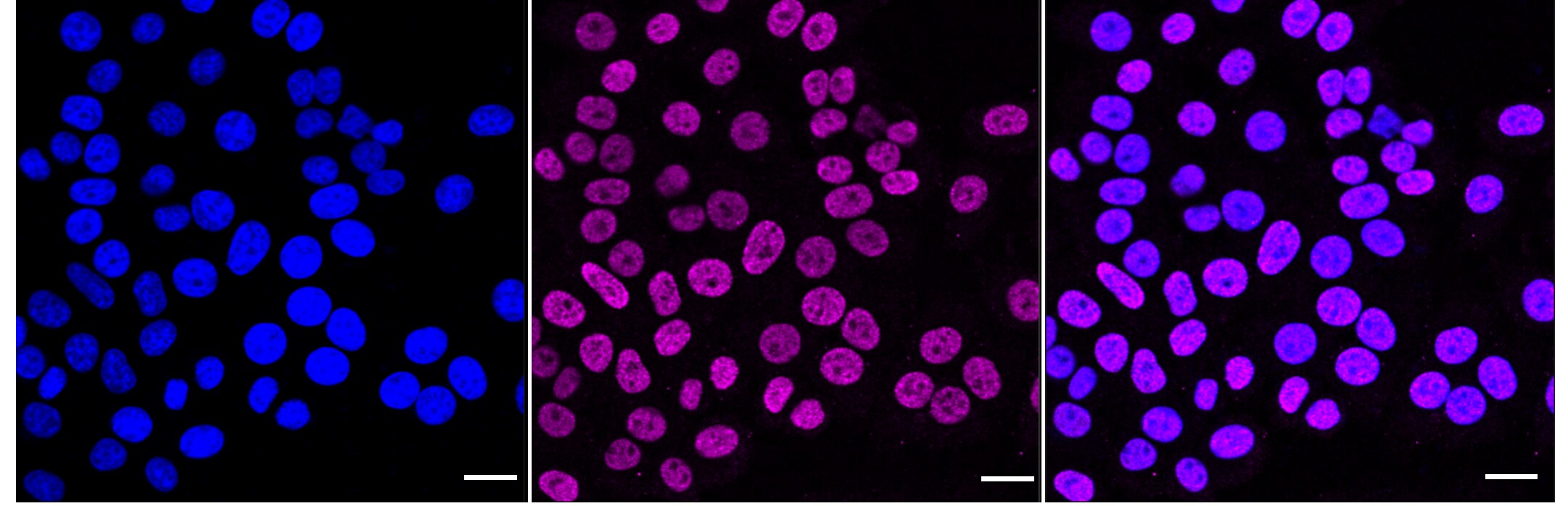 Histone H2B type 2E [ac Lys16] Antibody (23GB6340)