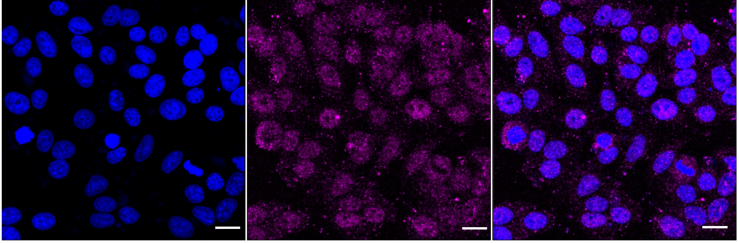 Hippocalcin Antibody (23GB6405)