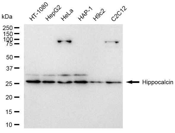 Hippocalcin Antibody (23GB6405)