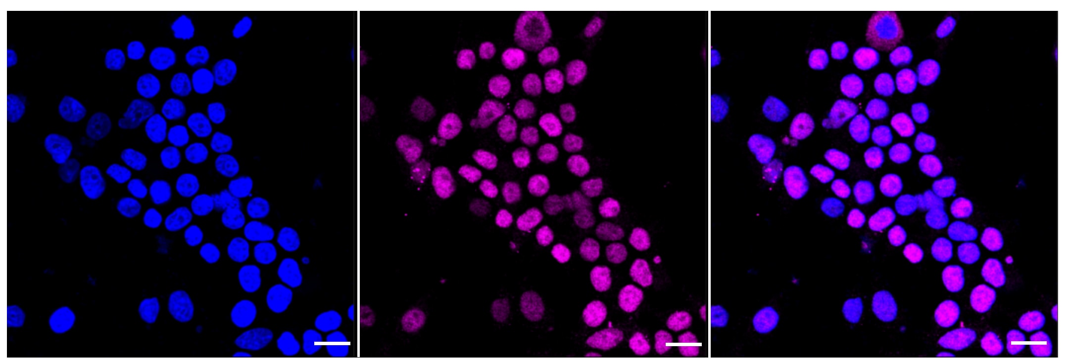 Islet-1 Antibody (23GB6450)