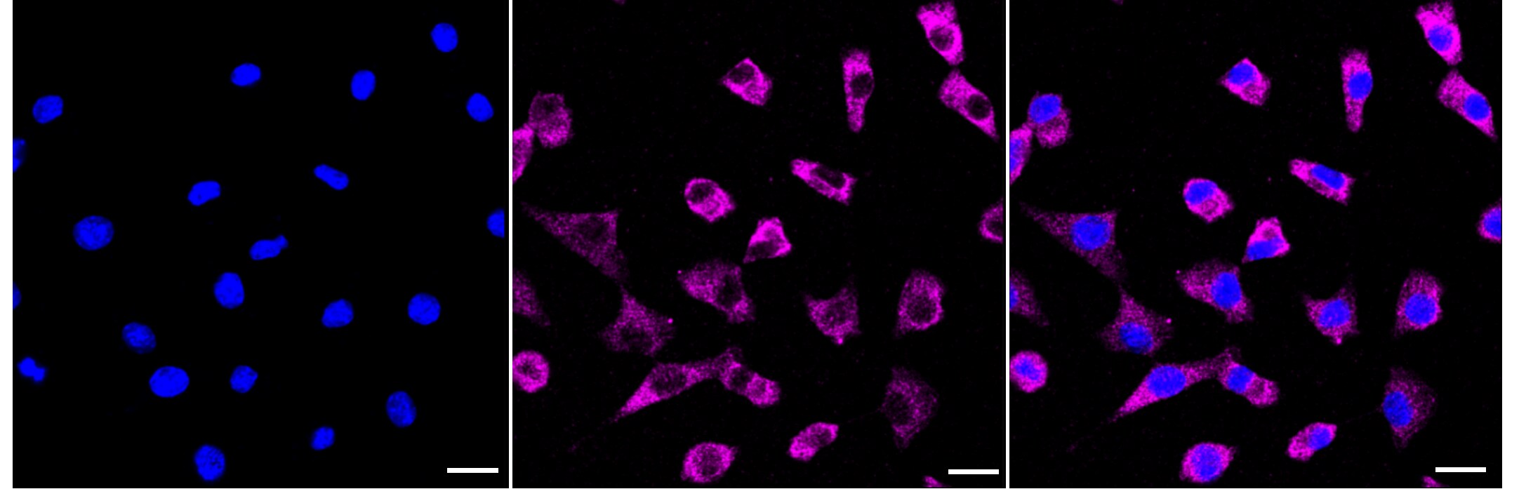 HAPLN1 Antibody (23GB6520)
