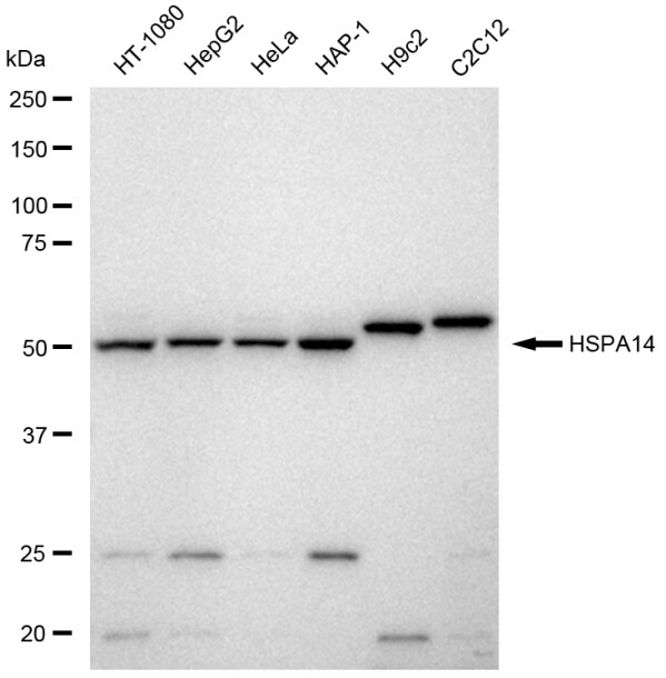 HSPA14 Antibody (23GB6565)