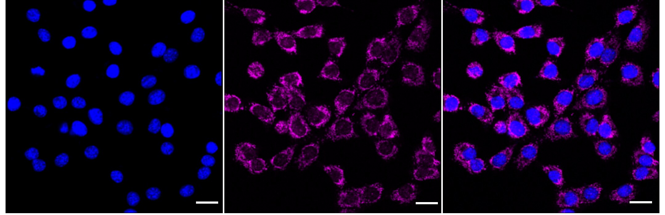 Isocitrate Dehydrogenase 2/IDH2 Antibody (23GB6580)