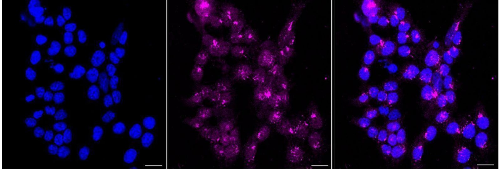 IGFBP-2 Antibody (23GB6635)