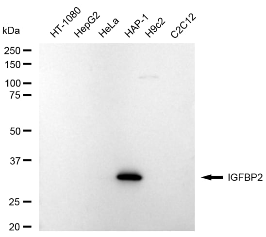IGFBP-2 Antibody (23GB6635)