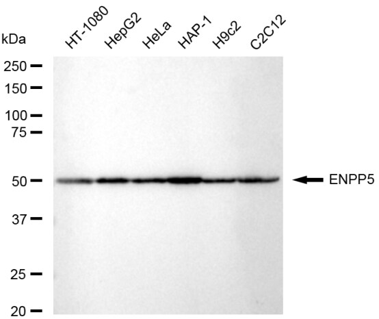 ENPP-5 Antibody (23GB5700)