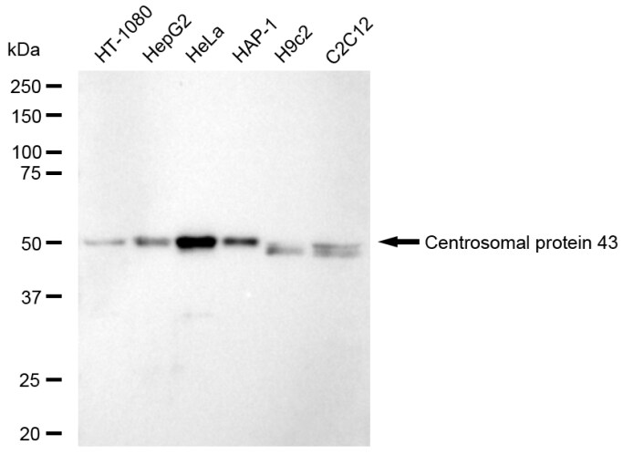 FGFR1OP Antibody (23GB5705)