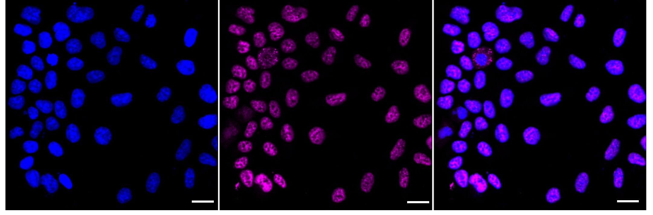Olig3 Antibody (24GB30)