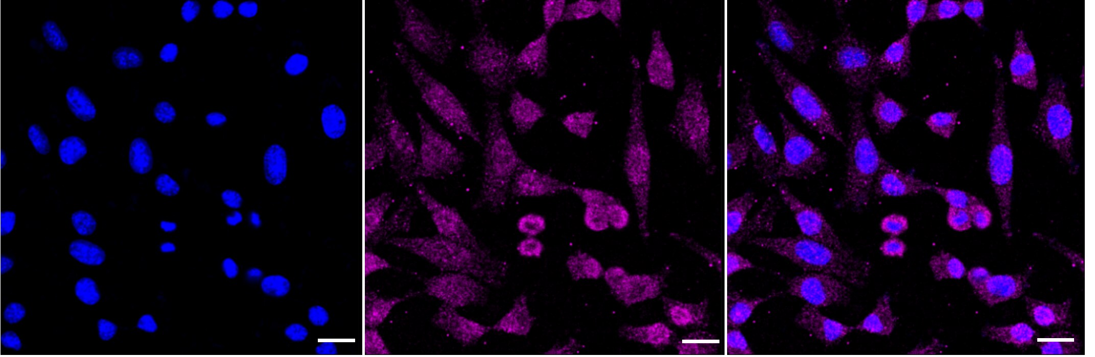 Leukotriene B4 R1 Antibody (24GB50)