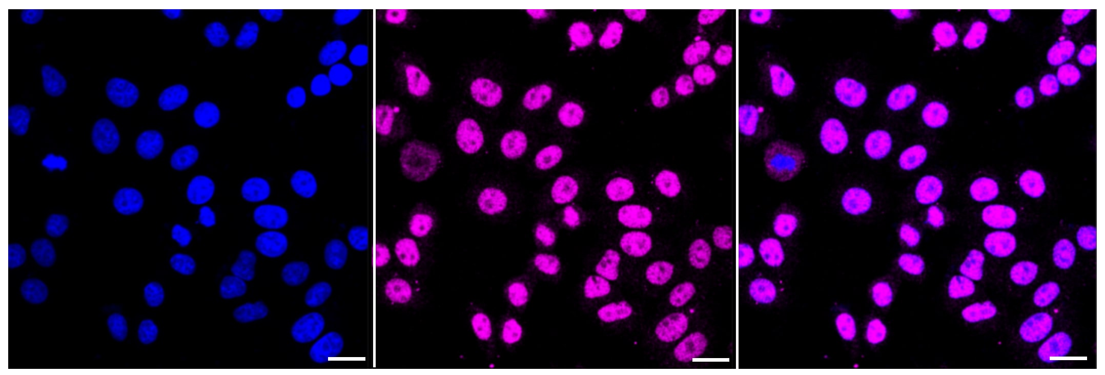 MEF2A Antibody (24GB85)
