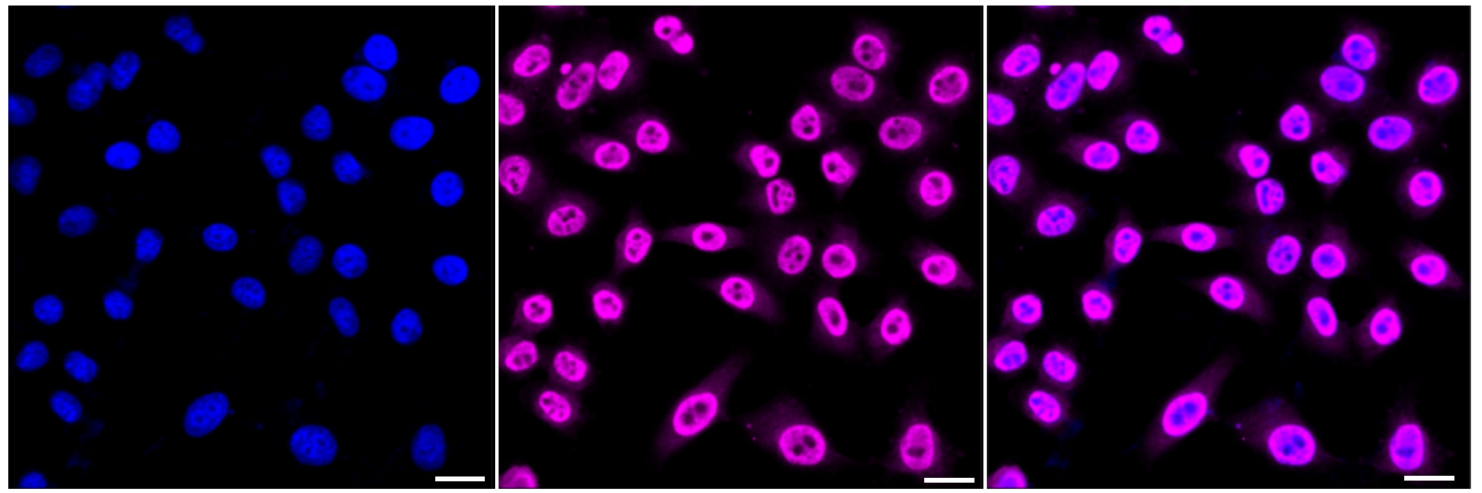 NPM1 [p Thr199] Antibody (24GB95)
