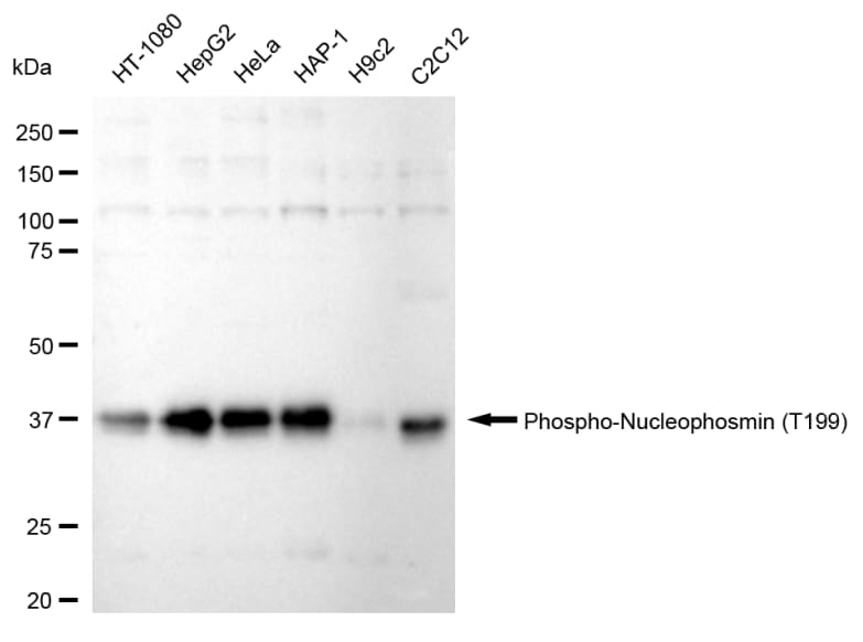 NPM1 [p Thr199] Antibody (24GB95)