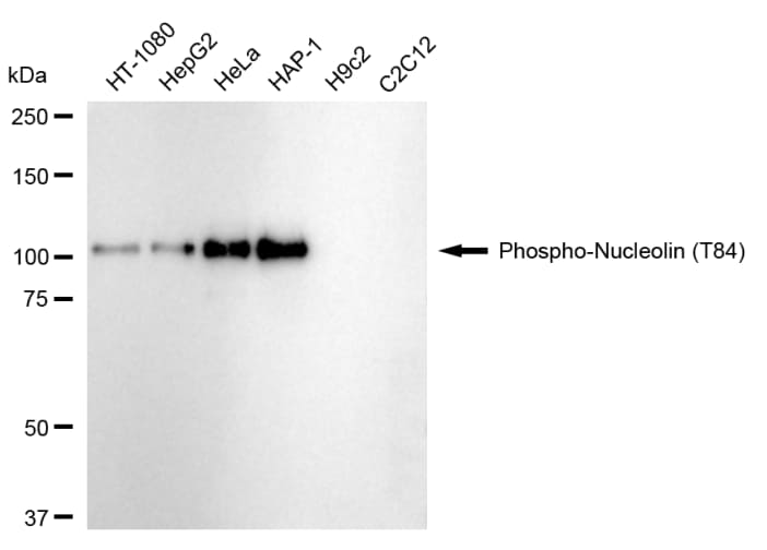 Nucleolin [p Thr84] Antibody (24GB130)