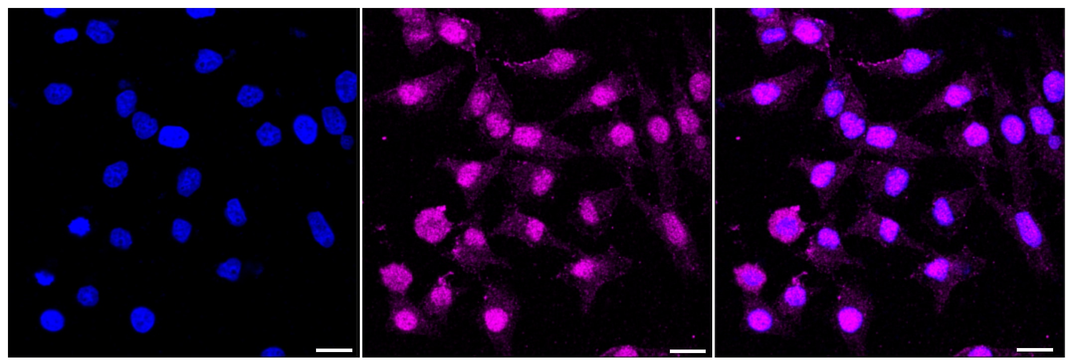 Nucleoporin 107 Antibody (24GB155)