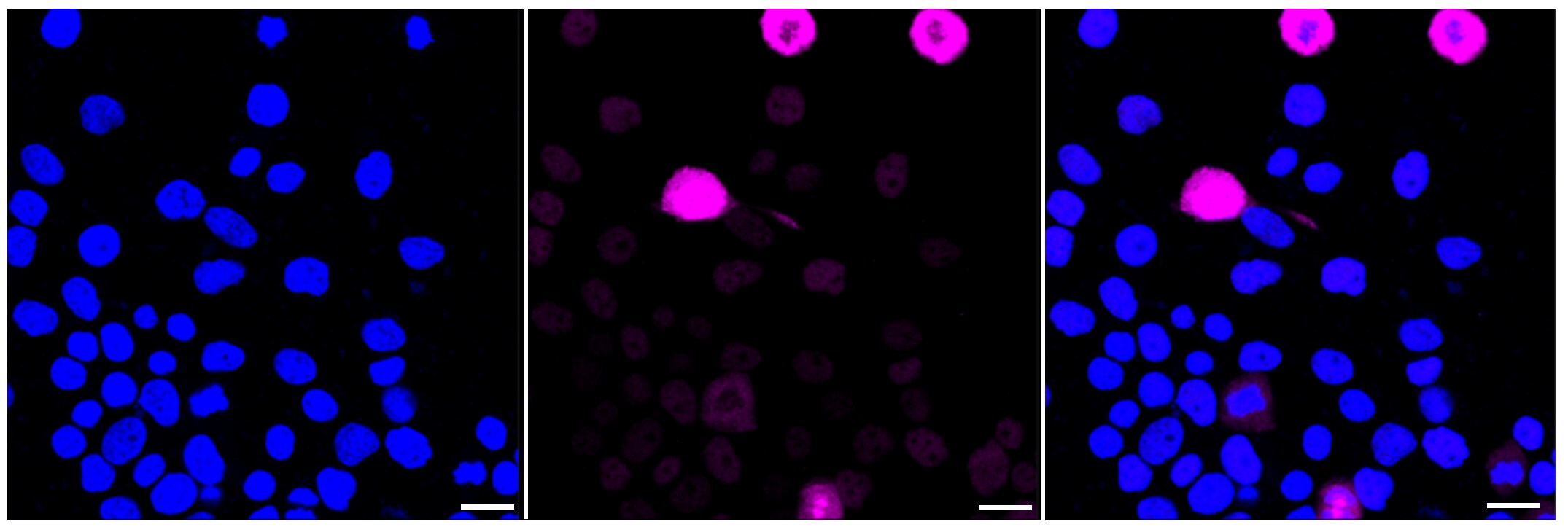 c-Myc [p Ser62] Antibody (24GB215)
