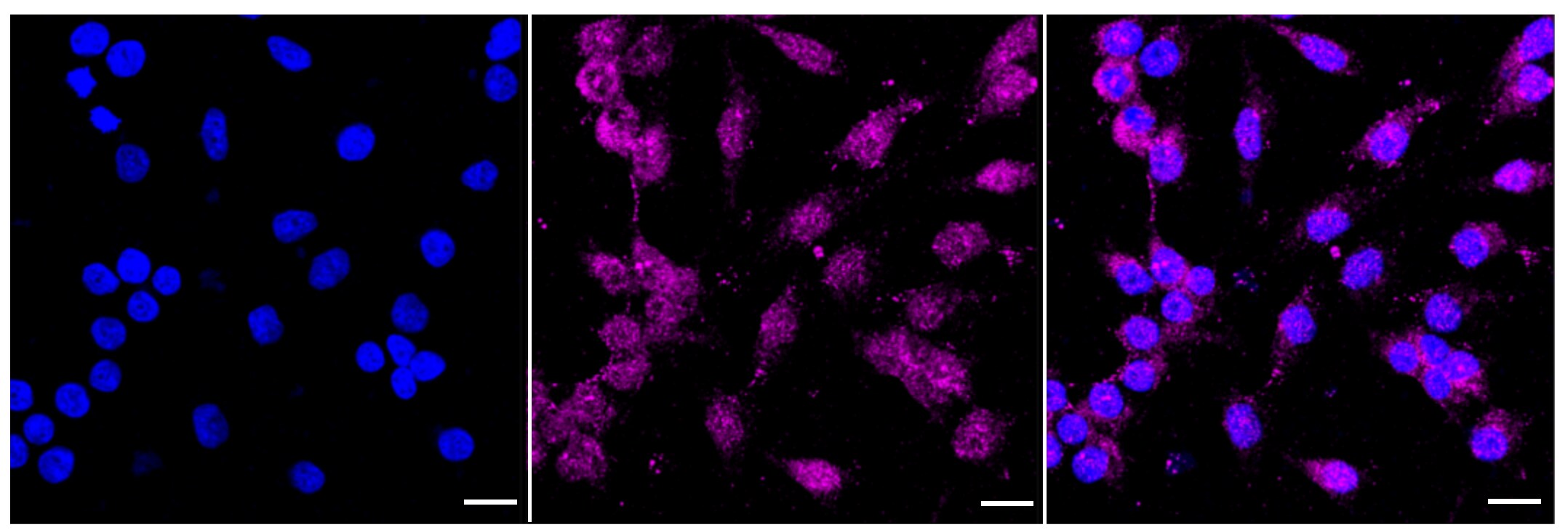 NRAS/HRAS/KRAS Antibody (24GB220)