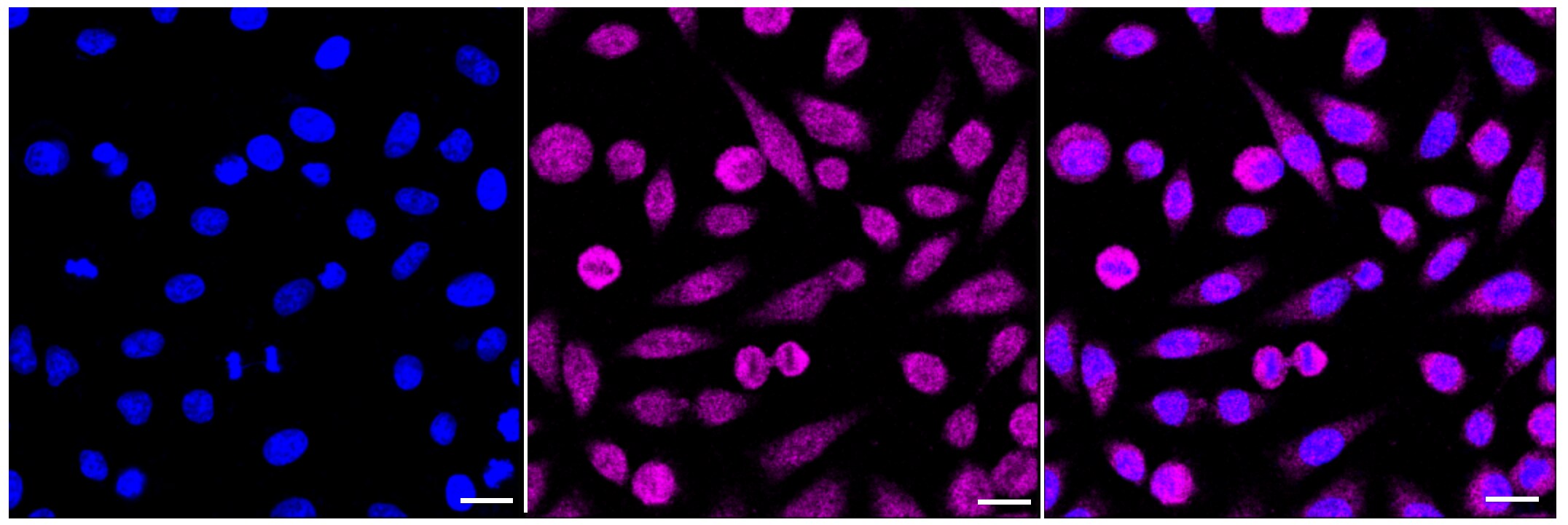 IkB-beta Antibody (24GB235)