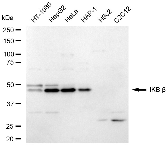 IkB-beta Antibody (24GB235)