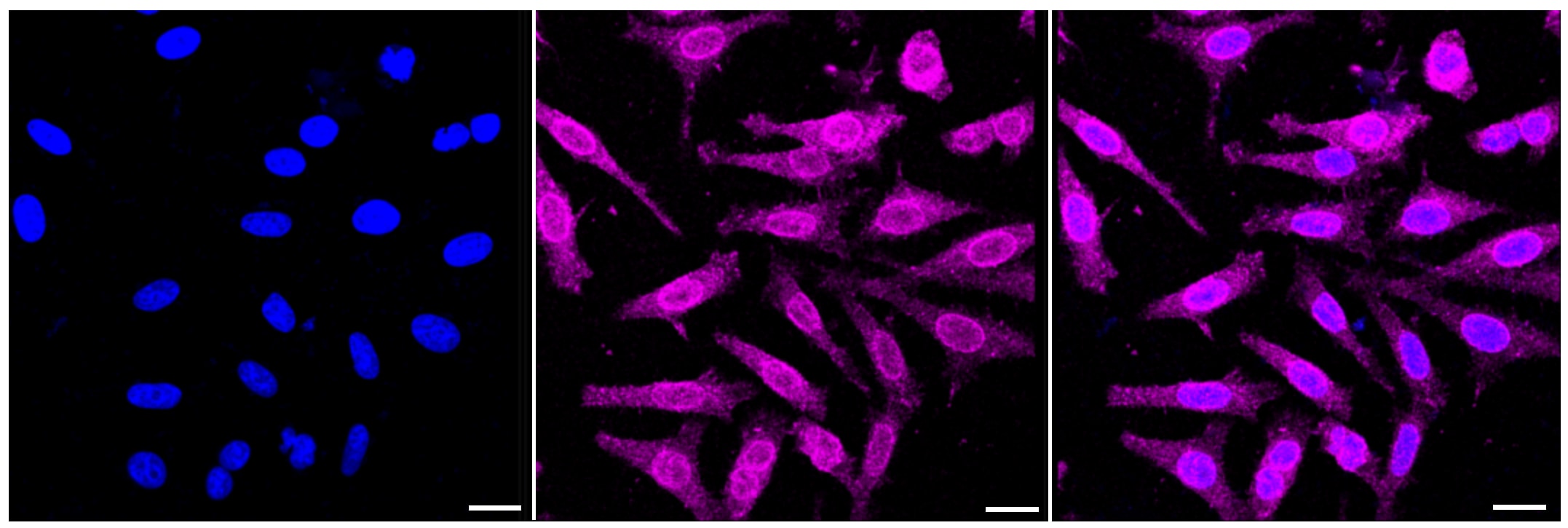 NRAS/HRAS/KRAS Antibody (24GB350)