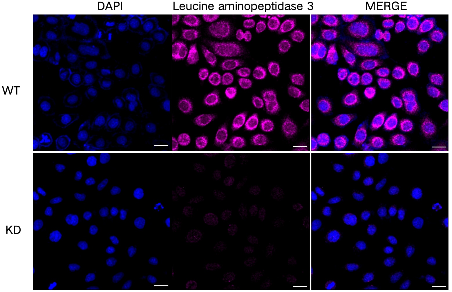 LAP3 Antibody (24GB5965)