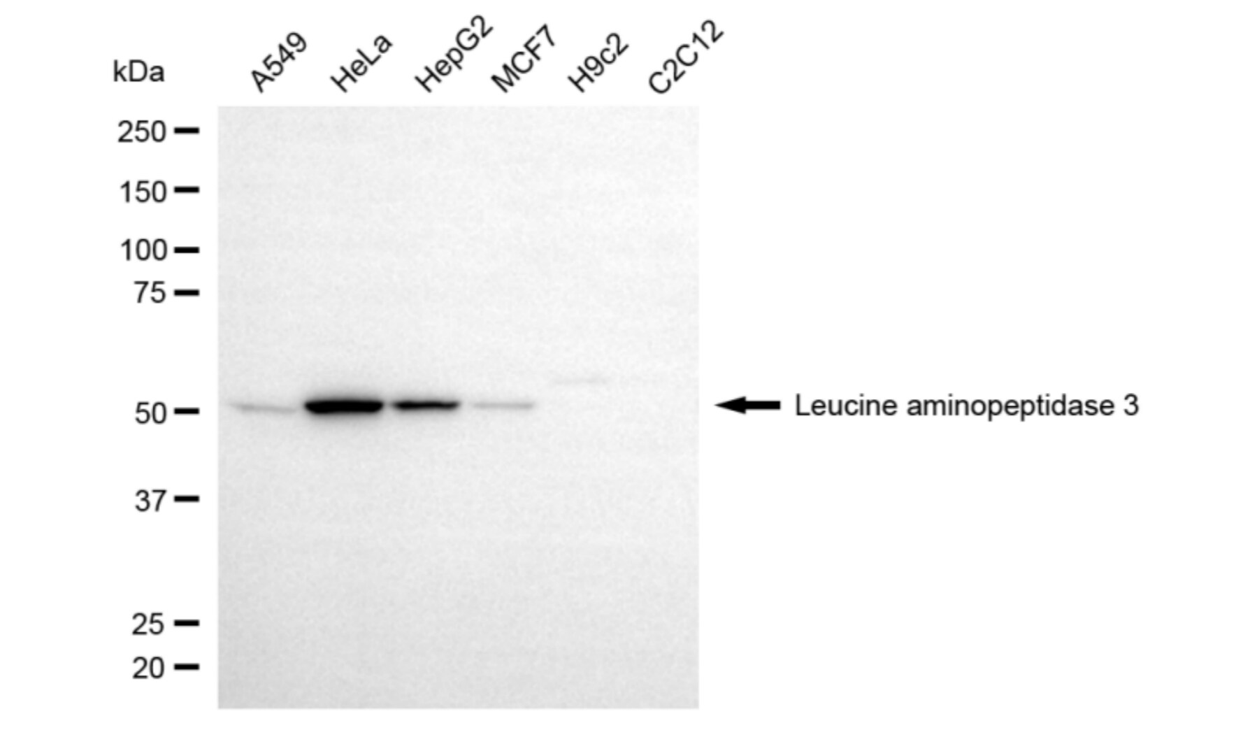 LAP3 Antibody (24GB5965)