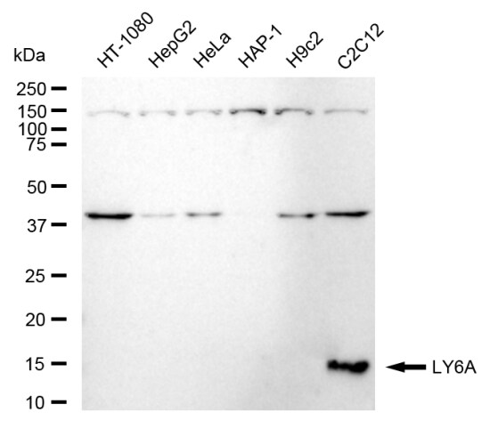 Ly-6A/E Antibody (24GB370)