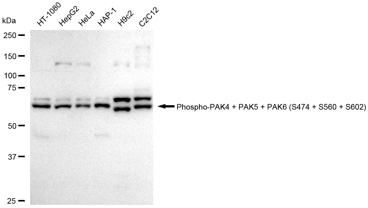 PAK4+5+6 [p Ser602] Antibody (24GB445)