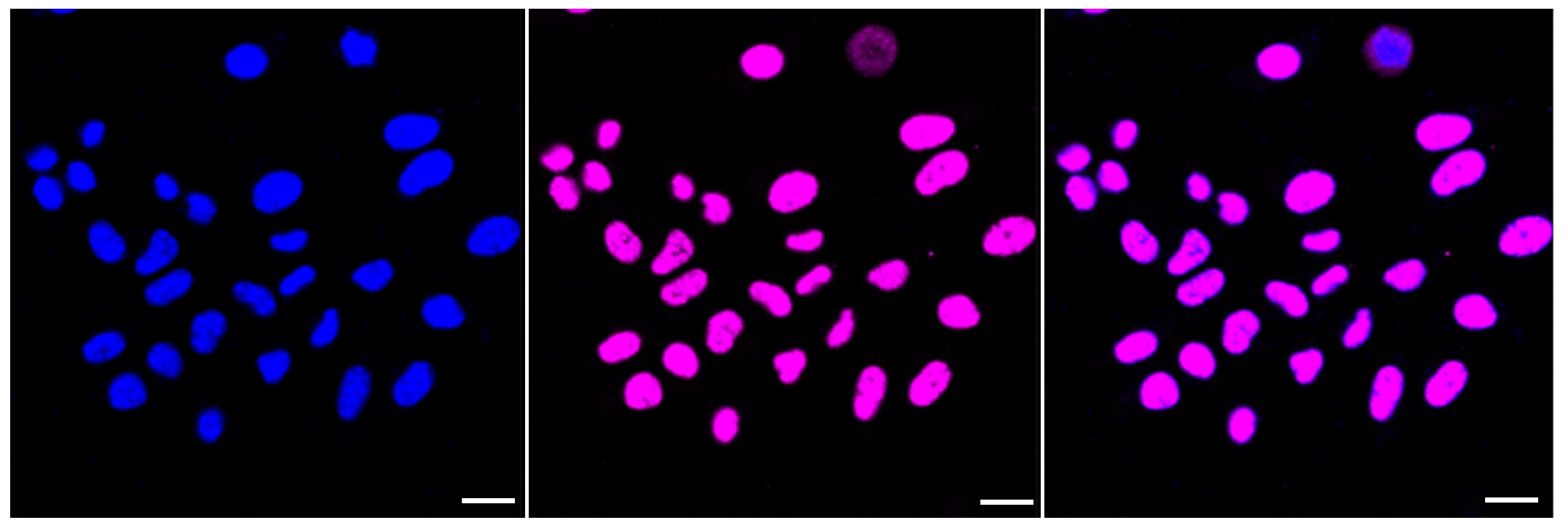 HDAC9 Antibody (23GB2045)