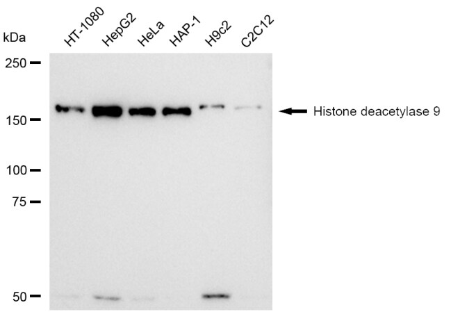 HDAC9 Antibody (23GB2045)
