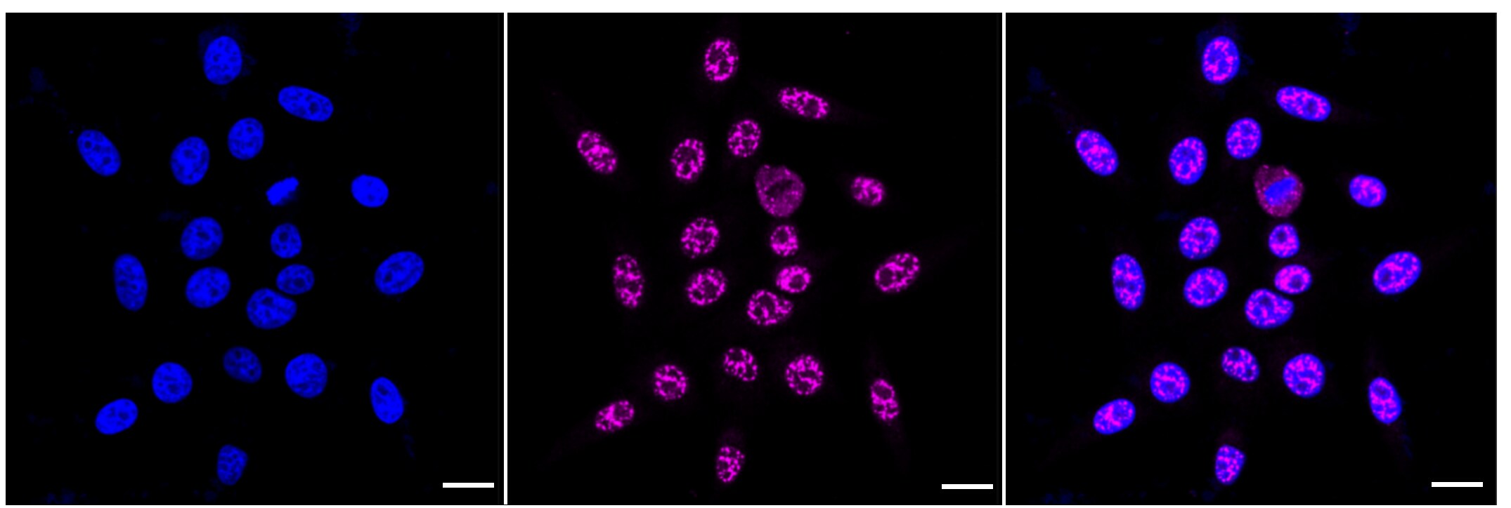 NDUFC2 Antibody (24GB505)