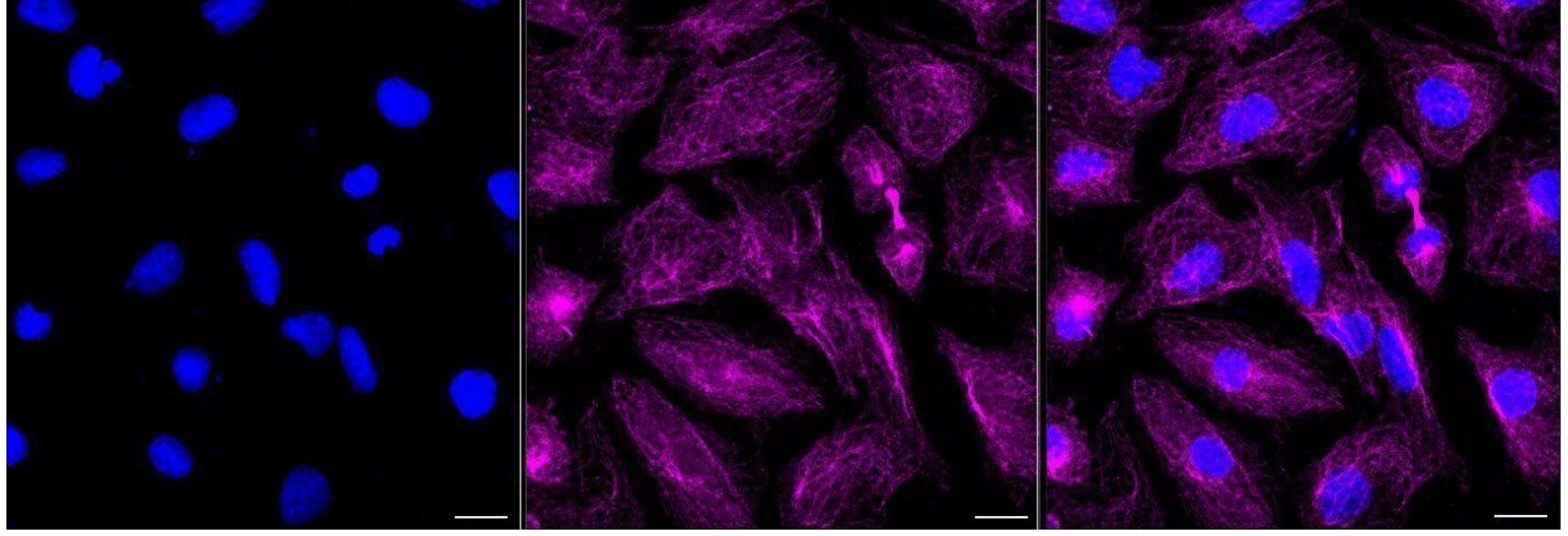 EB3 Antibody (24GB540)