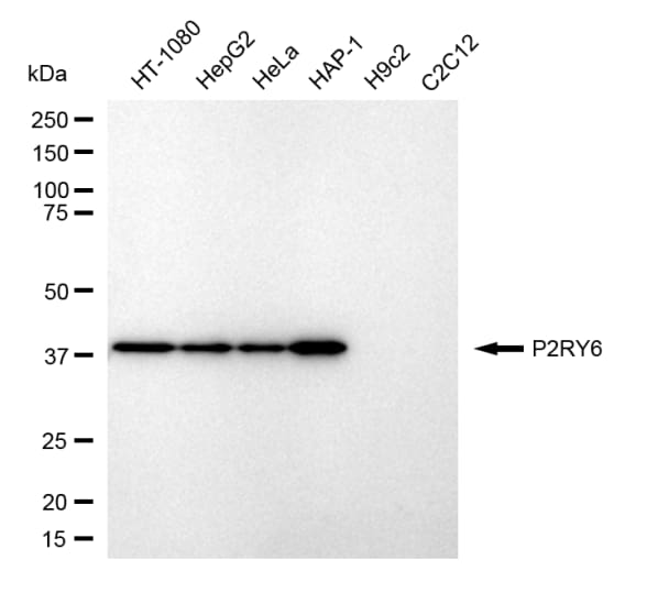P2Y6/P2RY6 Antibody (24GB590)
