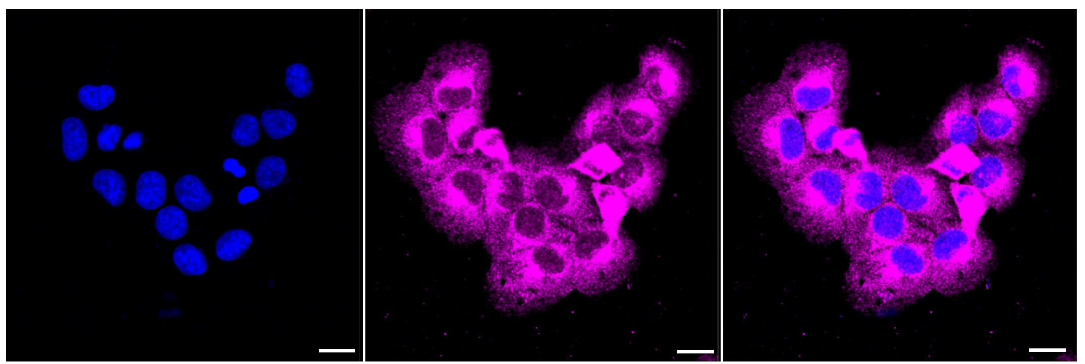 Niemann-Pick C1 Antibody (24GB620)