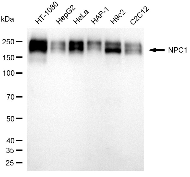 Niemann-Pick C1 Antibody (24GB620)