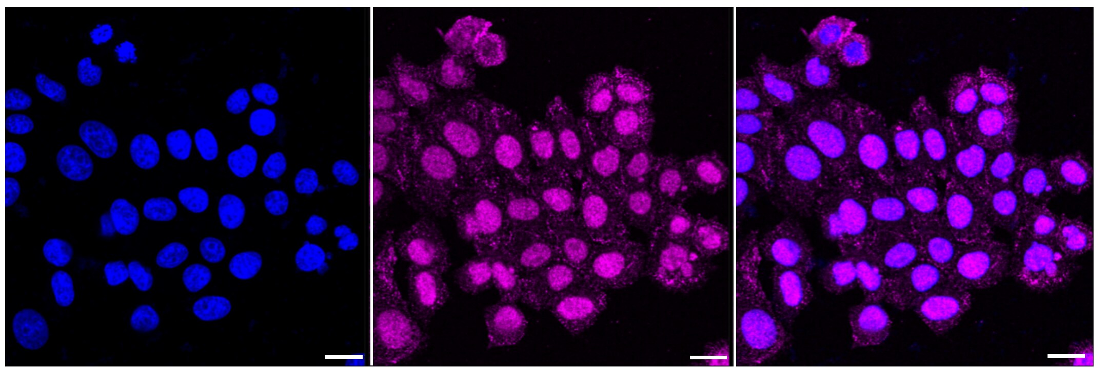 MSP/MST1 Antibody (24GB635)