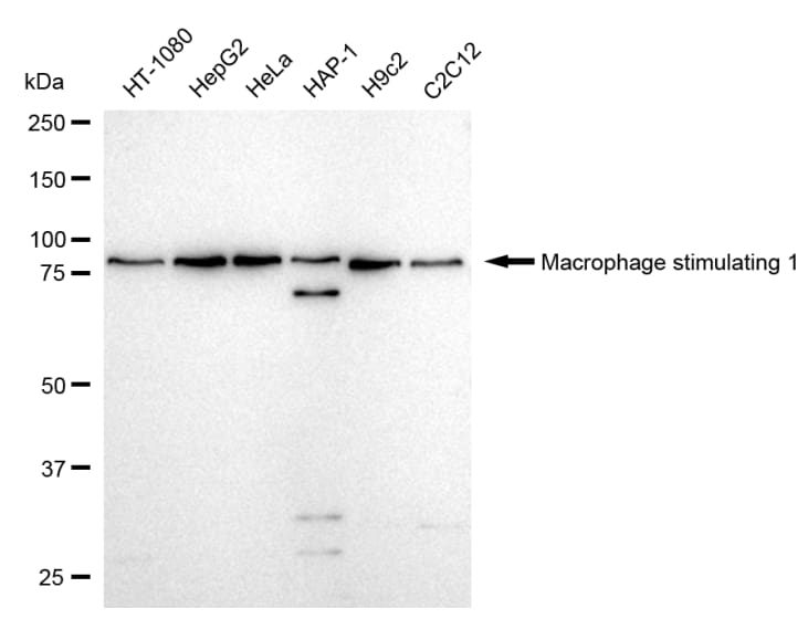 MSP/MST1 Antibody (24GB635)