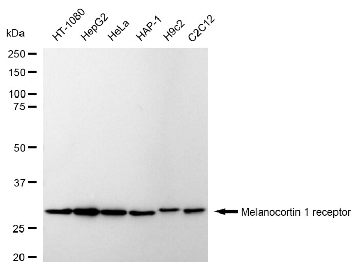 Melanocortin-1 R/MC1R Antibody (24GB640)