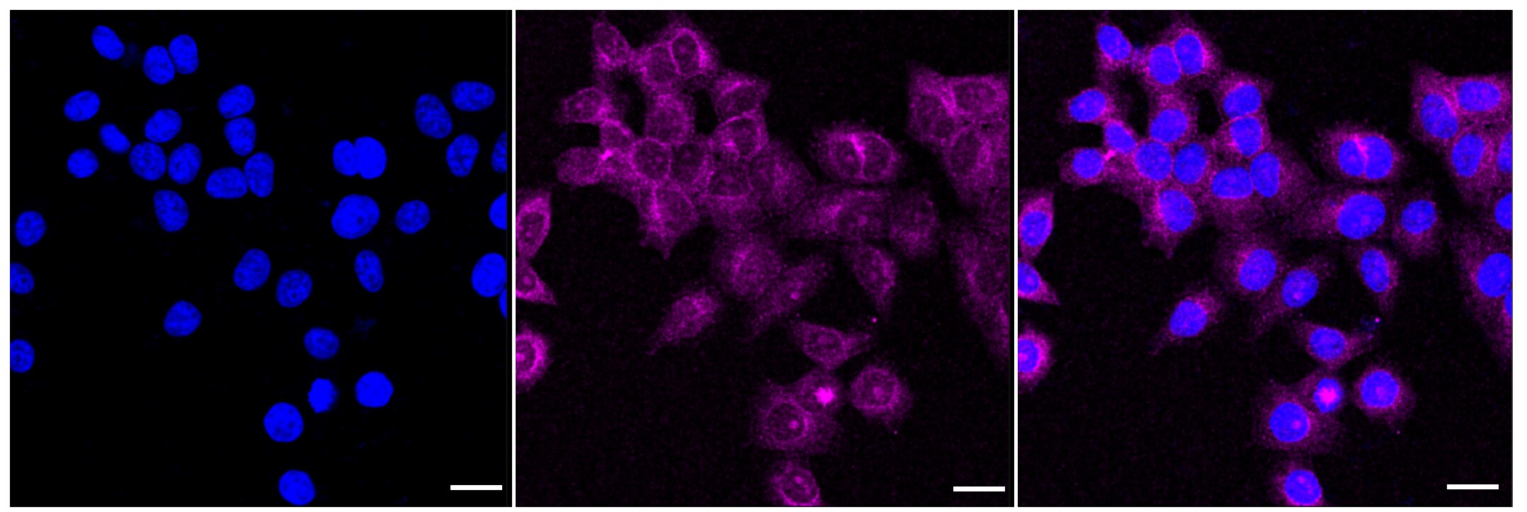 Myosin VIIa Antibody (24GB665)