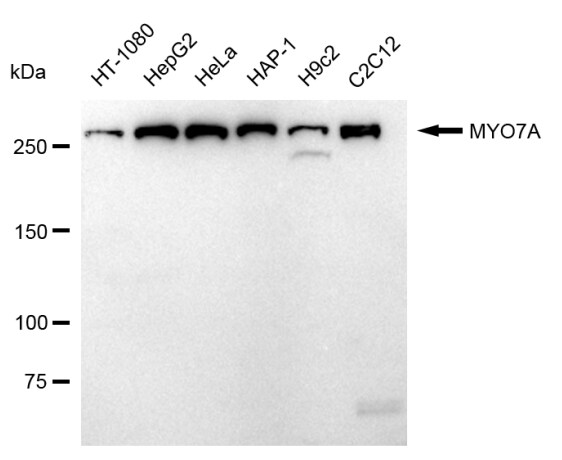 Myosin VIIa Antibody (24GB665)
