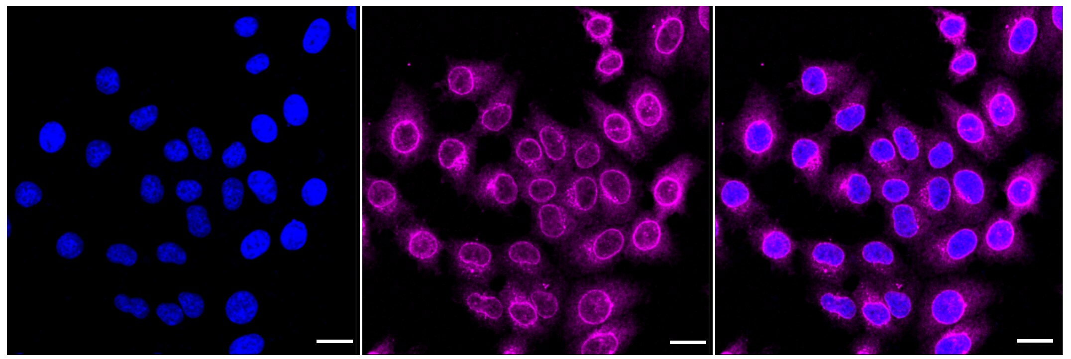 NUP62 Antibody (24GB700)